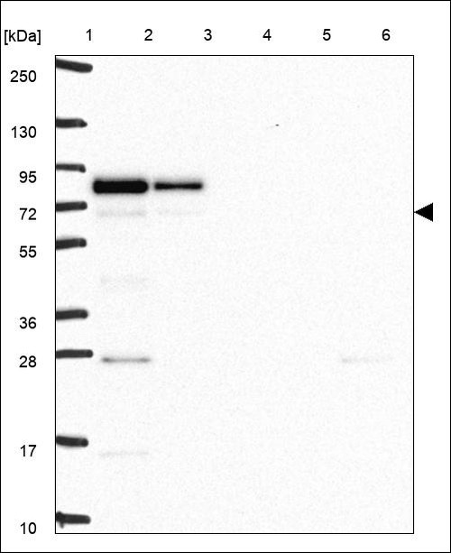 Lane 1: Marker [kDa] 250,130,95,72,55,36,28,17,10 Lane 2: RT4 Lane 3: U-251 MG Lane 4: Human Plasma Lane 5: Liver Lane 6: Tonsil