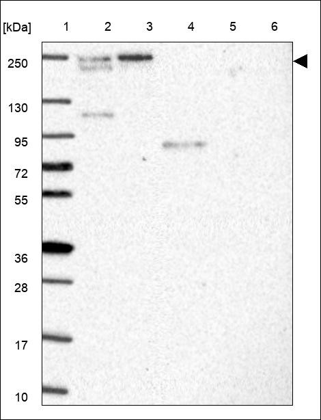 Lane 1: Marker [kDa] 250,130,95,72,55,36,28,17,10 Lane 2: RT4 Lane 3: U-251 MG Lane 4: Human Plasma Lane 5: Liver Lane 6: Tonsil