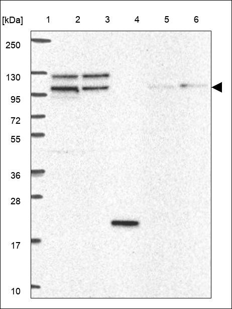 Lane 1: Marker [kDa] 250,130,95,72,55,36,28,17,10 Lane 2: RT4 Lane 3: U-251 MG Lane 4: Human Plasma Lane 5: Liver Lane 6: Tonsil