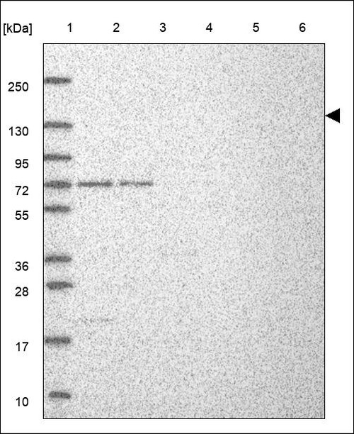 Lane 1: Marker [kDa] 250,130,95,72,55,36,28,17,10 Lane 2: RT4 Lane 3: U-251 MG Lane 4: Human Plasma Lane 5: Liver Lane 6: Tonsil