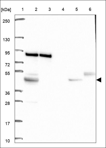 Lane 1: Marker [kDa] 250,130,95,72,55,36,28,17,10 Lane 2: RT4 Lane 3: U-251 MG Lane 4: Human Plasma Lane 5: Liver Lane 6: Tonsil