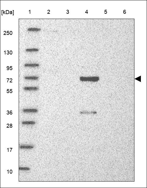 Lane 1: Marker [kDa] 250,130,95,72,55,36,28,17,10 Lane 2: RT4 Lane 3: U-251 MG Lane 4: Human Plasma Lane 5: Liver Lane 6: Tonsil
