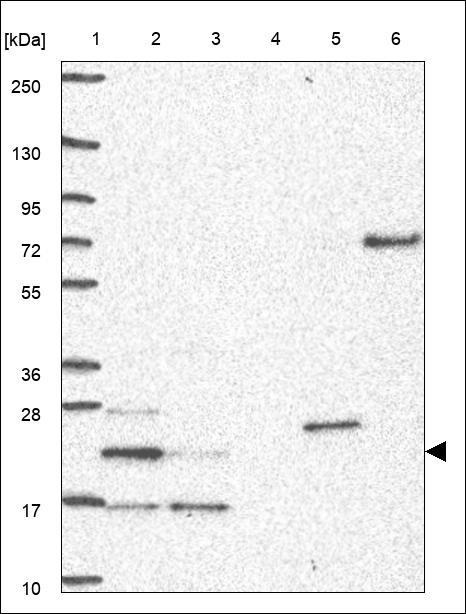 Lane 1: Marker [kDa] 250,130,95,72,55,36,28,17,10 Lane 2: RT4 Lane 3: U-251 MG Lane 4: Human Plasma Lane 5: Liver Lane 6: Tonsil