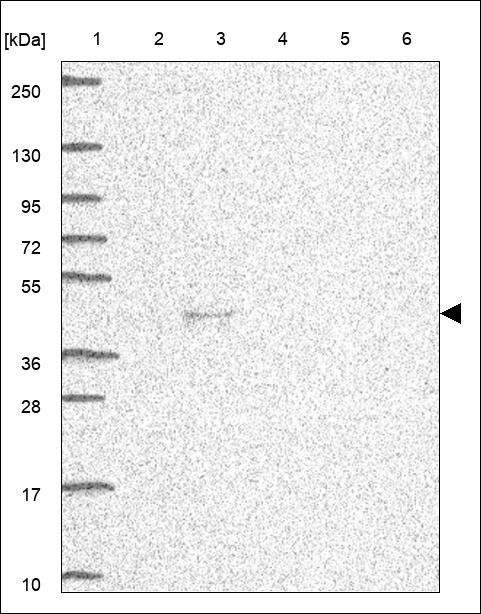 Lane 1: Marker [kDa] 250,130,95,72,55,36,28,17,10 Lane 2: RT4 Lane 3: U-251 MG Lane 4: Human Plasma Lane 5: Liver Lane 6: Tonsil