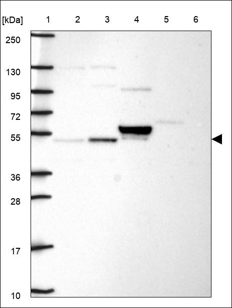 Lane 1: Marker [kDa] 250,130,95,72,55,36,28,17,10 Lane 2: RT4 Lane 3: U-251 MG Lane 4: Human Plasma Lane 5: Liver Lane 6: Tonsil