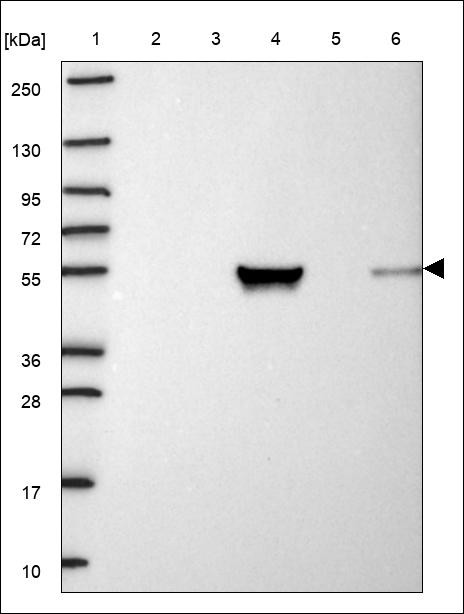 Lane 1: Marker [kDa] 250,130,95,72,55,36,28,17,10 Lane 2: RT4 Lane 3: U-251 MG Lane 4: Human Plasma Lane 5: Liver Lane 6: Tonsil