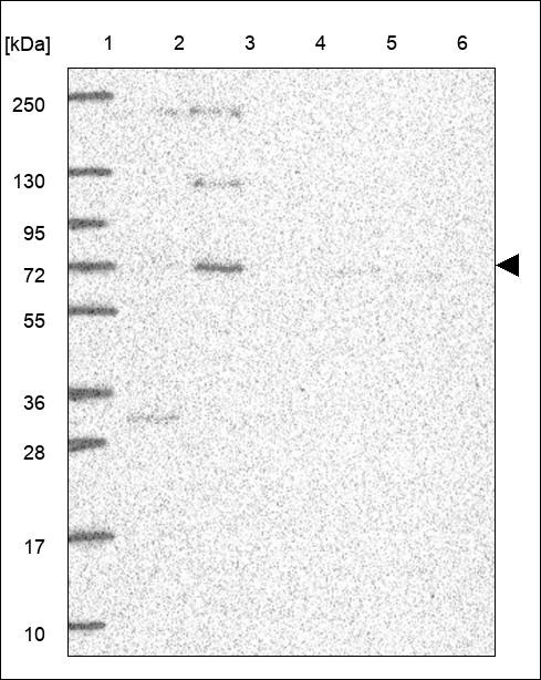 Lane 1: Marker [kDa] 250,130,95,72,55,36,28,17,10 Lane 2: RT4 Lane 3: U-251 MG Lane 4: Human Plasma Lane 5: Liver Lane 6: Tonsil