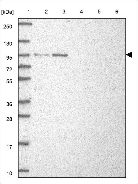 Lane 1: Marker [kDa] 250,130,95,72,55,36,28,17,10 Lane 2: RT4 Lane 3: U-251 MG Lane 4: Human Plasma Lane 5: Liver Lane 6: Tonsil