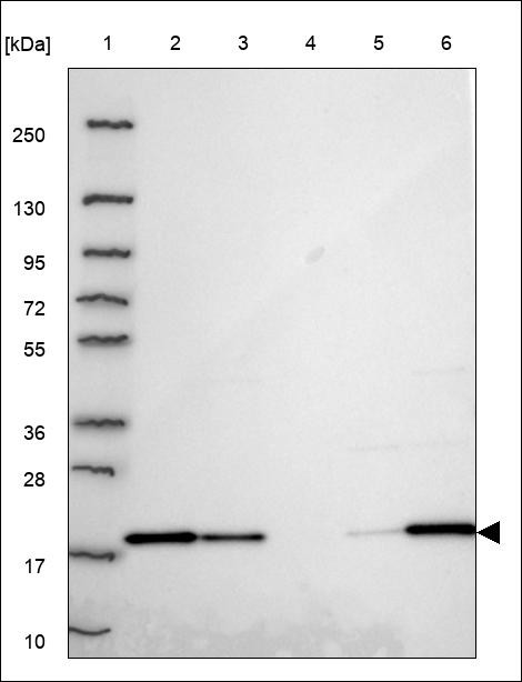 Lane 1: Marker [kDa] 250,130,95,72,55,36,28,17,10 Lane 2: RT4 Lane 3: U-251 MG Lane 4: Human Plasma Lane 5: Liver Lane 6: Tonsil