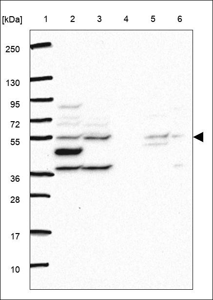 Lane 1: Marker [kDa] 250,130,95,72,55,36,28,17,10 Lane 2: RT4 Lane 3: U-251 MG Lane 4: Human Plasma Lane 5: Liver Lane 6: Tonsil