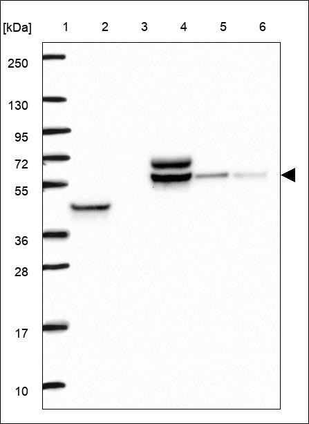 Lane 1: Marker [kDa] 250,130,95,72,55,36,28,17,10 Lane 2: RT4 Lane 3: U-251 MG Lane 4: Human Plasma Lane 5: Liver Lane 6: Tonsil
