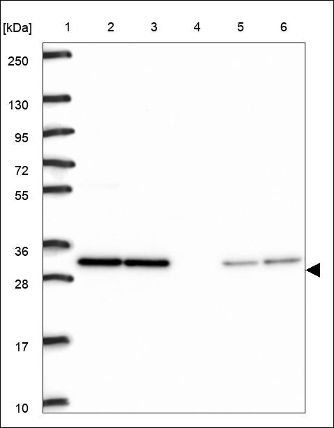 Lane 1: Marker [kDa] 250,130,95,72,55,36,28,17,10 Lane 2: RT4 Lane 3: U-251 MG Lane 4: Human Plasma Lane 5: Liver Lane 6: Tonsil