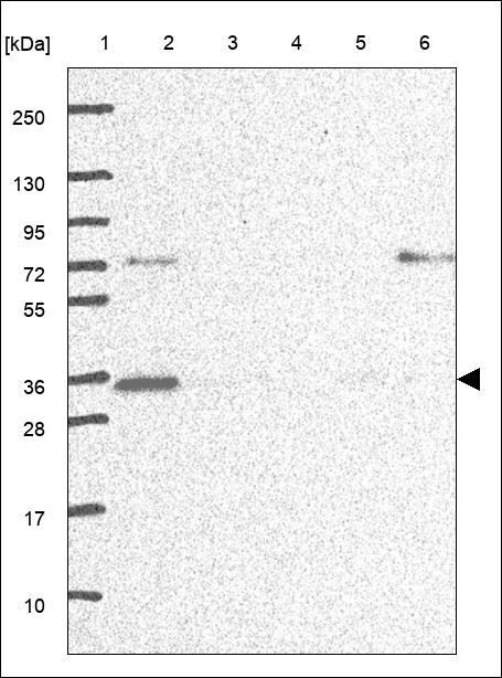 Lane 1: Marker [kDa] 250,130,95,72,55,36,28,17,10 Lane 2: RT4 Lane 3: U-251 MG Lane 4: Human Plasma Lane 5: Liver Lane 6: Tonsil