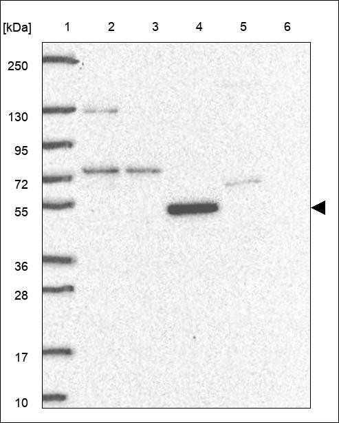 Lane 1: Marker [kDa] 250,130,95,72,55,36,28,17,10 Lane 2: RT4 Lane 3: U-251 MG Lane 4: Human Plasma Lane 5: Liver Lane 6: Tonsil