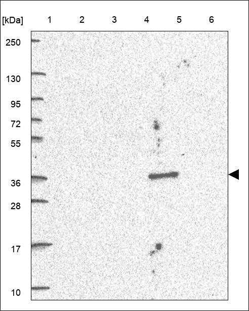 Lane 1: Marker [kDa] 250,130,95,72,55,36,28,17,10 Lane 2: RT4 Lane 3: U-251 MG Lane 4: Human Plasma Lane 5: Liver Lane 6: Tonsil