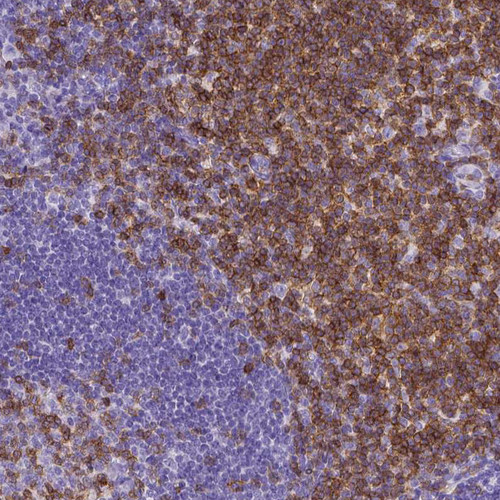 Immunohistochemical staining of human tonsil shows moderate to strong membranous positivity, mainly in non - germinal center cells.