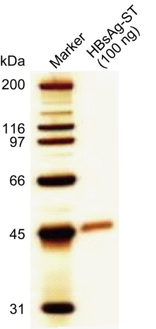 HBV Surface Antigen (HBsAg) L-protein-ST