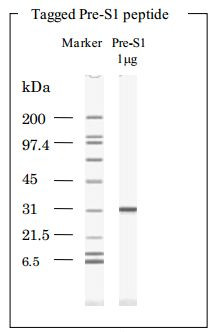 HBsAg, Pre-S1 peptide