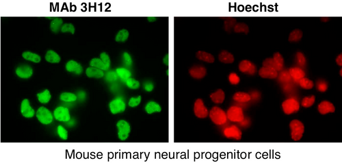 Immunocytochemistry/Immunofluorescence analysis of SUMO2/3 antibody (3H12) on mouse primary culture neurons. Immunocytochemistry/Immunofluorescence analysis of SUMO2/3 antibody (3H12) on mouse primary culture neurons.