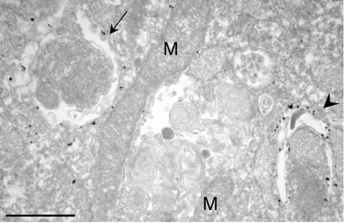 Figure 2. Immuno-electron microscopy analysis of mouse embryonic fibroblasts (MEFs).MEFs were cultured in DMEM without amino acids for 2 hr. After fixation with 4% paraformaldehyde for 2 hr at room temperature, they were permeabilized with liquid nitrogen. Immuno-electron microscopy analysis (pre-embedding method) of endogenous LC3 was performed using #1703 anti-LC3 antibody at 1:10 dilution. The gold labeling was intensified by using a silver enhancement kit (HQ silver enhancement kit, Nanoprobes, NY).