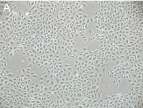 Endothelial Cells (porcine) Endothelial Cells (porcine)