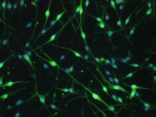 Schwann Cell Line (IMS32), mouse