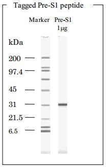 Hepatitis B Virus Surface Antigen Pre-S1 peptides (Recombinant) Genotype A,B,C,D