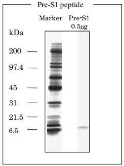 Hepatitis B Virus Surface Antigen Pre-S1 peptides (Recombinant) Genotype A,B,C,D