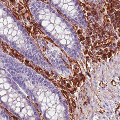 Immunohistochemical staining of human rectum shows strong positivity in mesenchymal and lymphoid cells.