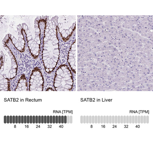 Immunohistochemistry analysis in human rectum and liver tissues using AMAb90679 antibody. Corresponding SATB2 RNA-seq data are presented for the same tissues.