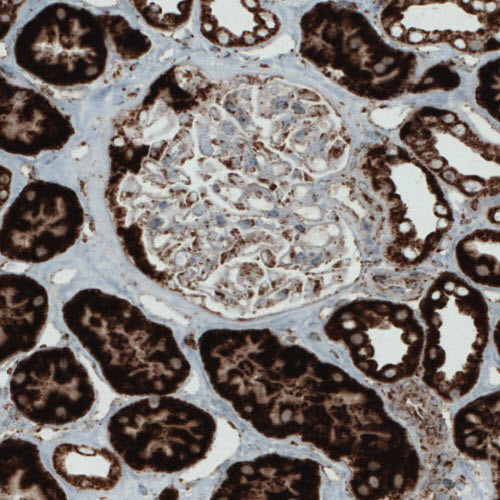 Immunohistochemical staining of human kidney shows strong cytoplasmic positivity in renal tubules.