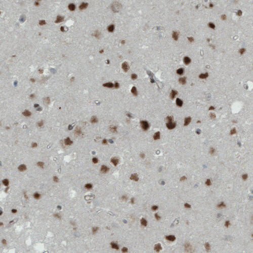 Immunohistochemical staining of human cerebral cortex shows strong immunoreactivity in neuronal cells.