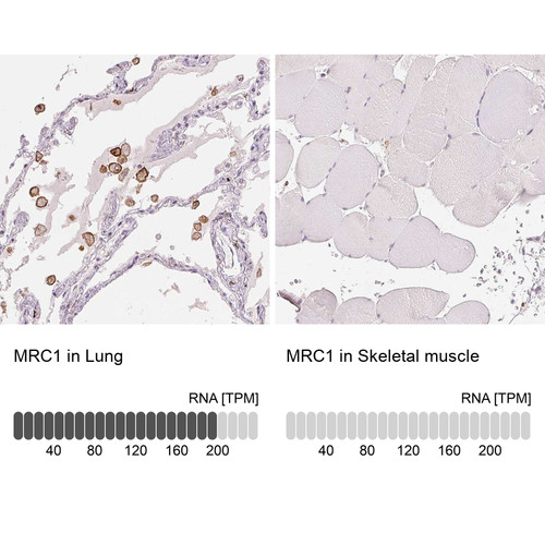 Immunohistochemical staining of human lung shows strong immunoreactivity in macrophages. Immunohistochemical staining of human lung shows strong immunoreactivity in macrophages.