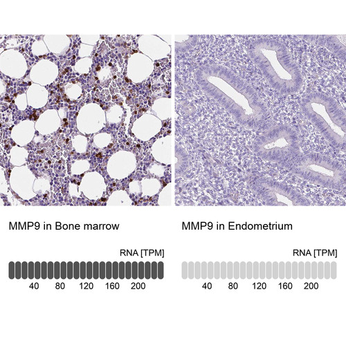 Immunohistochemical staining of human duodenum shows strong cytoplasmic positivity in a subset of lymphoid cells.