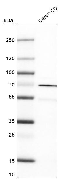 Western blot analysis in human cerebral cortex tissue.
