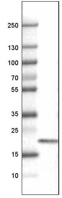 Lane 1: Marker [kDa]<br/>Lane 2: Human tonsil