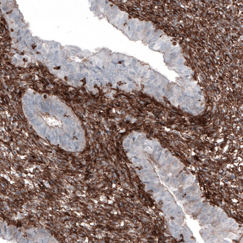 Immunohistochemical staining of human endometrium shows strong cytoplasmic positivity in stromal cells.
