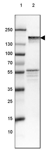 Lane 1: Marker [kDa] 250, 130, 100, 70, 55, 35, 25, 15, 10<br/>Lane 2: Human Cerebral Cortex tissue