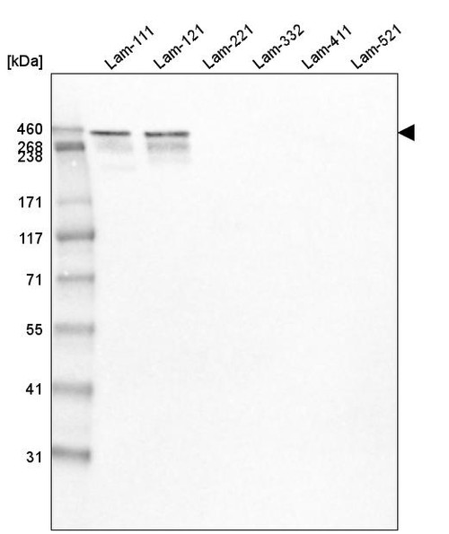 Western blot analysis of purified human recombinant Laminin-111, Laminin-121,  Laminin-221, Laminin-332, Laminin-411 and Laminin-521.