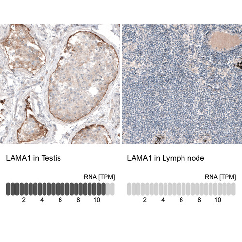 Immunohistochemistry analysis in human testis and lymph node tissues using AMAb91117 antibody. Corresponding LAMA1 RNA-seq data are presented for the same tissues.