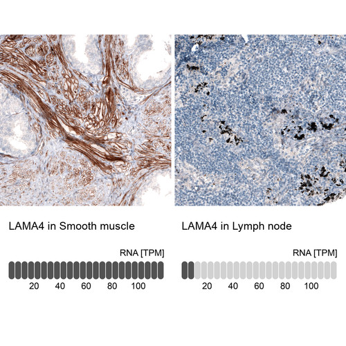 Immunohistochemistry analysis in human smooth muscle and lymph node tissues using AMAb91134 antibody. Corresponding LAMA4 RNA-seq data are presented for the same tissues.