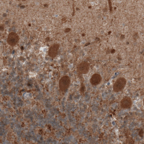 Immunohistochemical staining of human cerebellum shows moderate positivity in Purkinje cells.