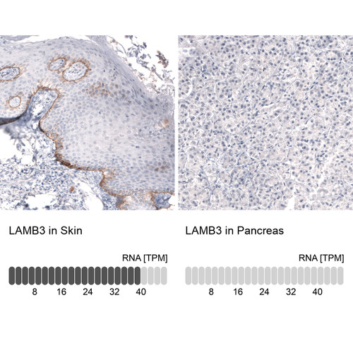 Immunohistochemistry analysis in human skin and pancreas tissues using AMAb91160 antibody. Corresponding LAMB3 RNA-seq data are presented for the same tissues.