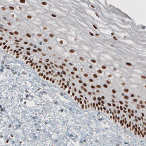 Immunohistochemical staining of human cervix shows strong nuclear immunoreactivity in epithelial cells.