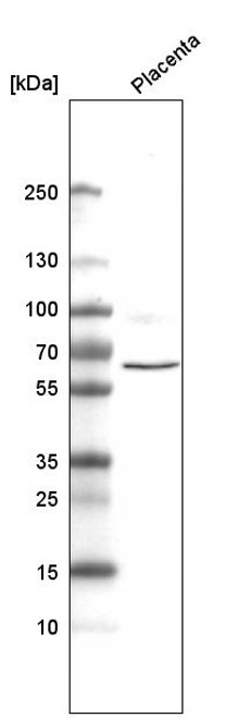 Western blot analysis in human placenta tissue. Western blot analysis in human placenta tissue.