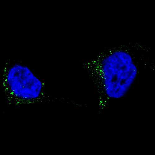 Immunofluorescence staining of SK-MEL-30 cells using the Anti-TYRP1 monoclonal antibody, showing specific staining in the vesicles in green. Microtubule- and nuclear probes are visualized in red and blue, respectively (where available).