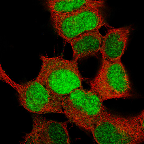 Immunofluorescence staining of SH-SY5Y cells using the Anti-SOX4 monoclonal antibody, showing specific staining in the nucleoplasm in green. Microtubule- and nuclear probes are visualized in red and blue, respectively (where available). 