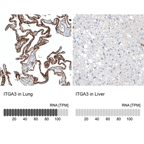 Immunohistochemistry analysis in human lung and liver tissues using AMAb91446 antibody. Corresponding ITGA3 RNA-seq data are presented for the same tissues.