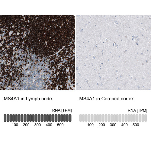 Immunohistochemistry analysis in human lymph node and cerebral cortex tissues using AMAb91636 antibody. Corresponding MS4A1 RNA-seq data are presented for the same tissues.