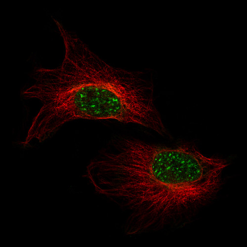 Immunofluorescence staining of U-138 MG cells using the Anti-CRYAB monoclonal antibody, showing specific staining in nuclear speckles in green. Microtubule- and nuclear probes are visualized in red and blue, respectively (where available).